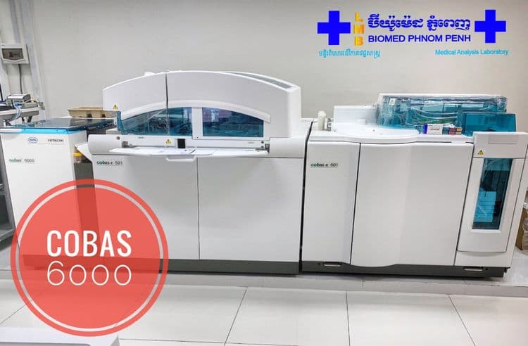 Cobas® 6000 analyzer series